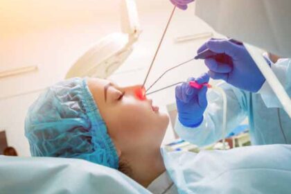 Sinus Dilation Devices Market