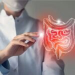 Colorectal Cancer Screening