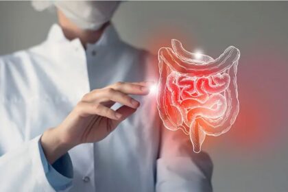 Colorectal Cancer Screening