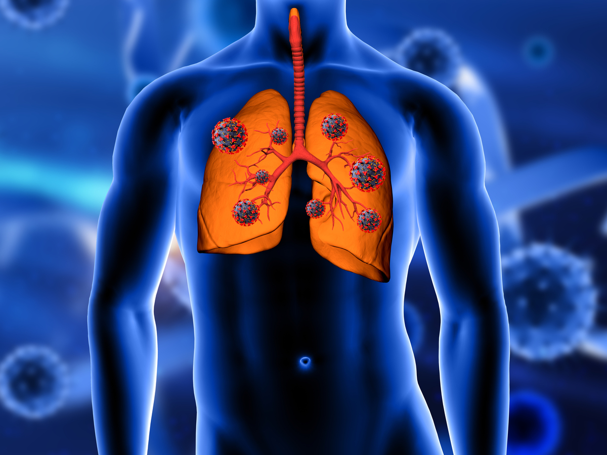 Tuberculosis Therapeutics Market